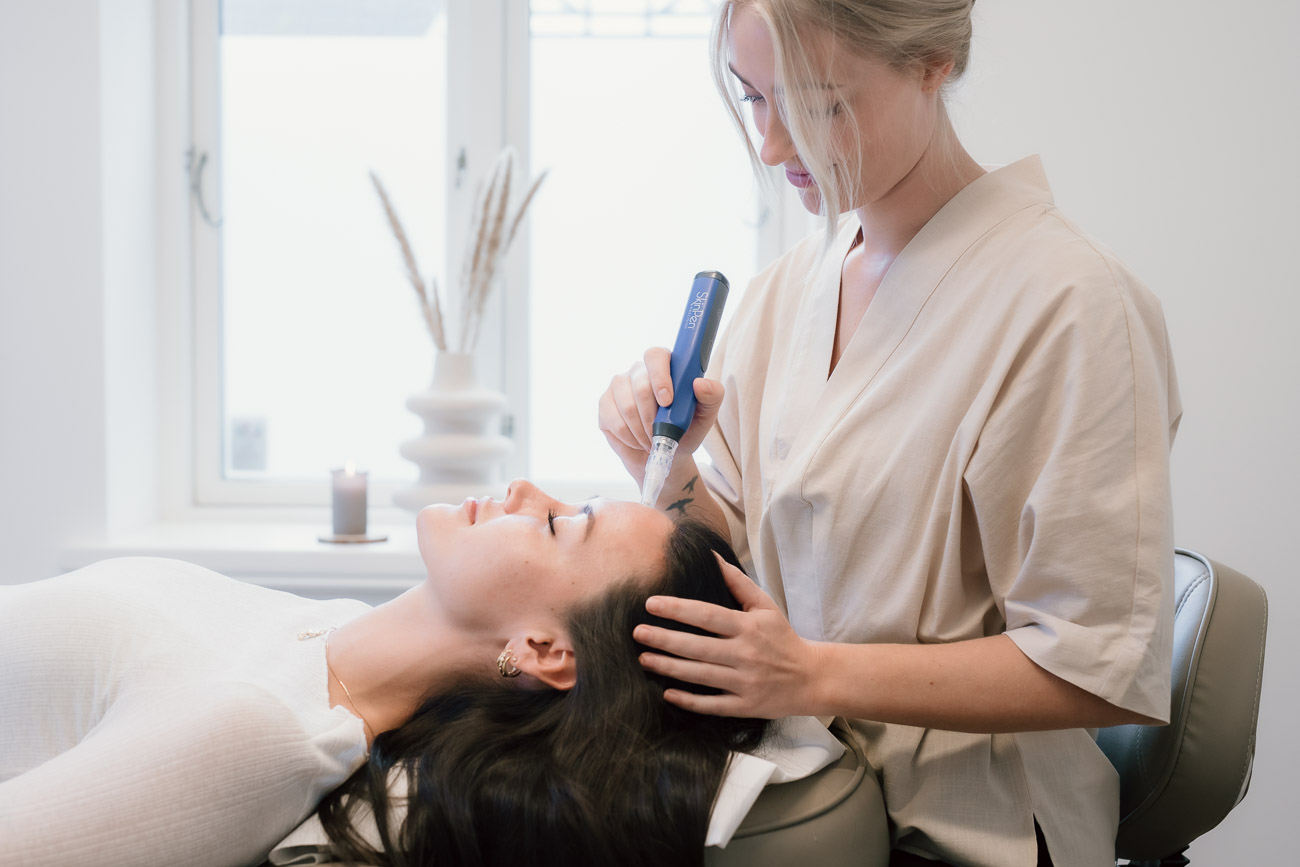 IMG_9310 microneedling