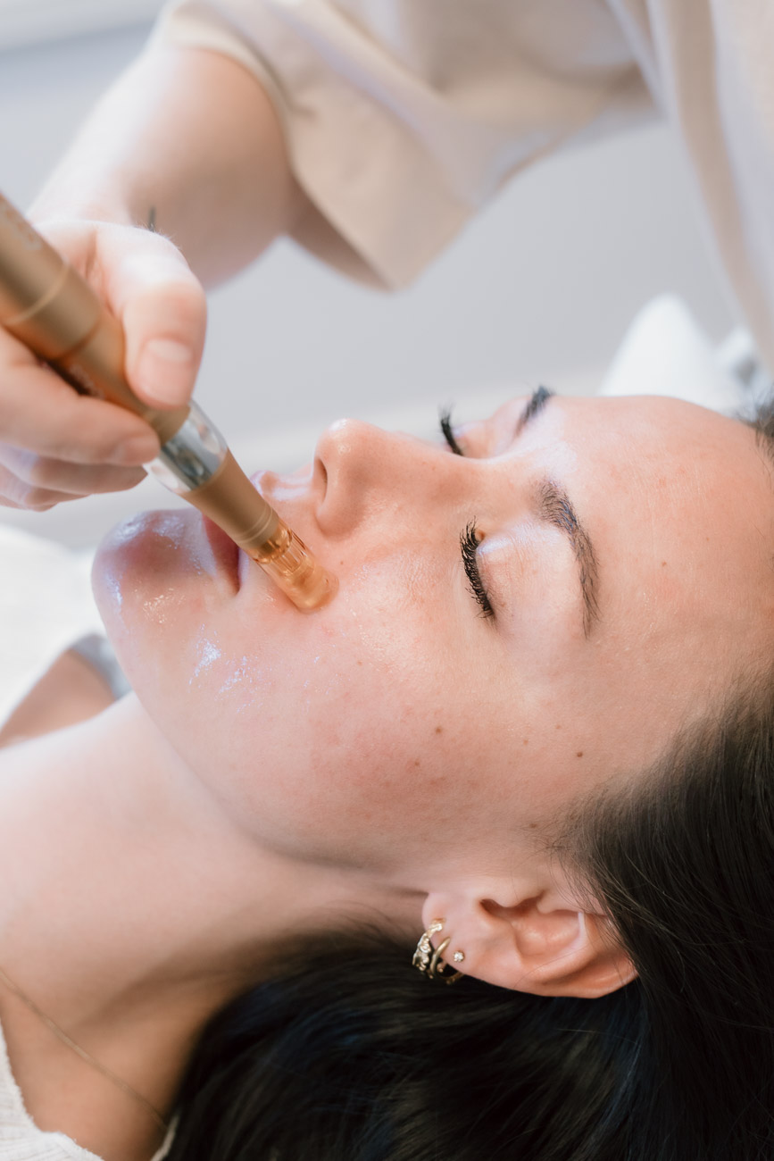 IMG_9339 Meso tearpi